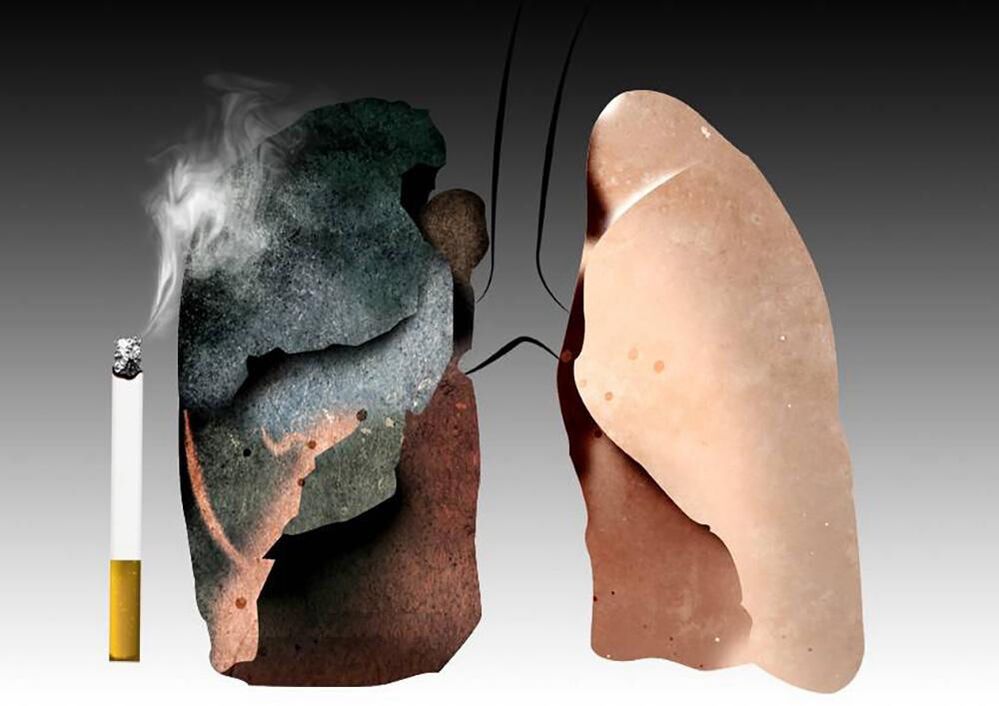 les poumons du fumeur